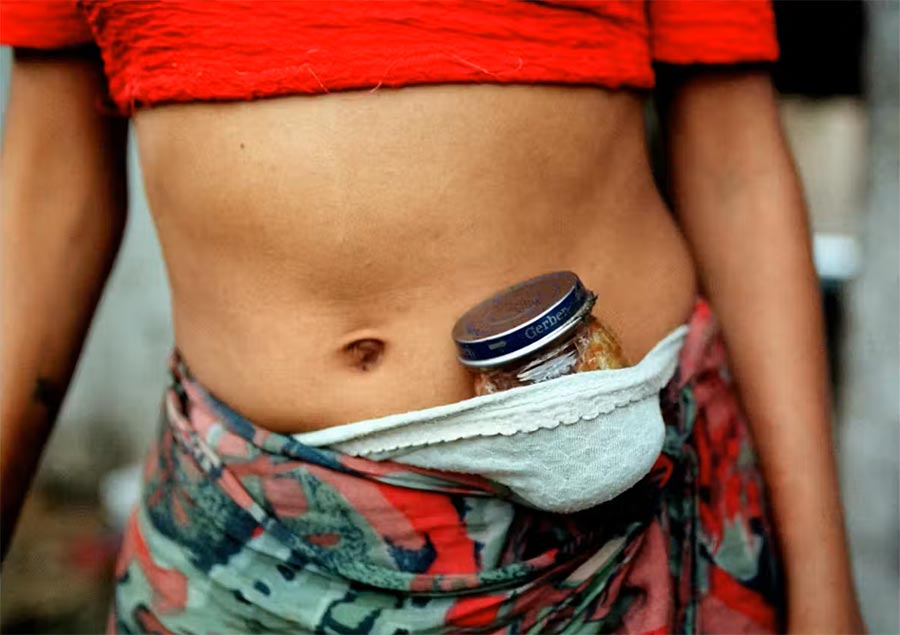 A young girl transporting “glue” (a highly addictive drug) in La Casita, near the centre of Managua in December 1999.